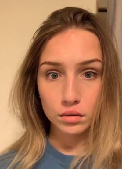 Experts waarschuwen voor spotgoedkoop alternatief lipfillers: ‘Plak nooit je bovenlip vast met superlijm’