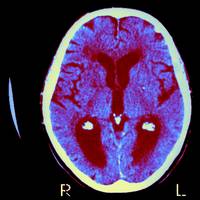 Hersenen doorlopen vijf fasen in het leven: keerpunten rond 9, 32, 66 en 83 jaar