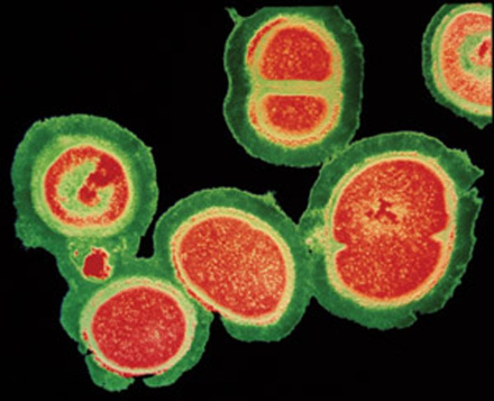 Afbeeldingsresultaat voor mrsa