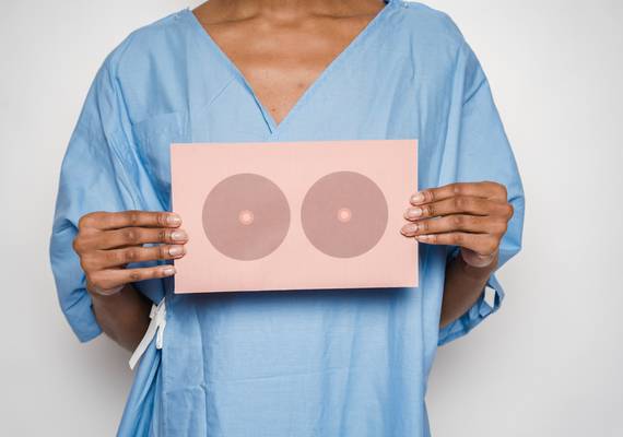 Tjitske (45) kiest voor een platte borstkas na borstkanker: “Geen pijnlijke prothese meer voor mij”
