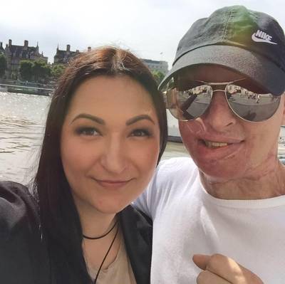 Door ex verminkte man vindt opnieuw de liefde bij vrouw die hem verzorgt