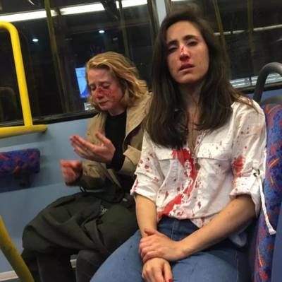 Vier tieners opgepakt na mishandeling lesbisch stel dat weigerde te zoenen