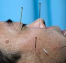 De blijde intocht van de oosterse geneeskunde: 