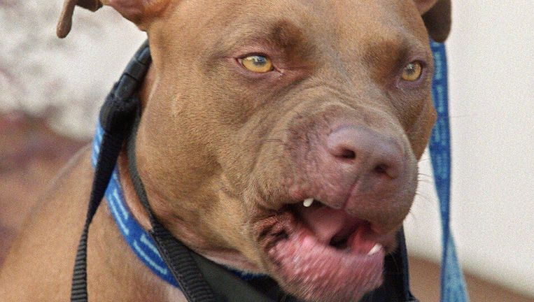 6 Jarig Meisje Door Pitbull In Gezicht Gebeten In West Het Parool
