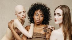 Modellenbureau zet alle soorten schoonheid in de kijker: “Het doet er niet toe hoeveel benen je hebt”