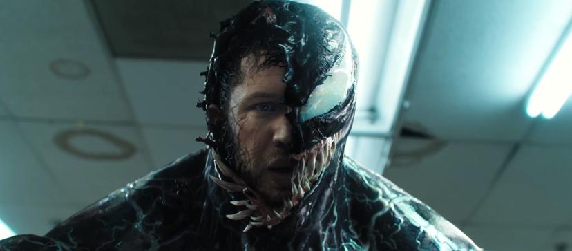 Tom Hardy als Eddie Brock in Venom