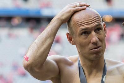 Ancelotti stelt rentree Robben toch nog uit: 'Nemen geen risico'