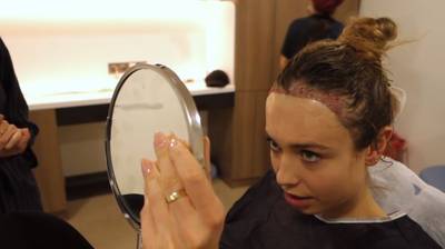 Loiza Lamers deelt beelden van langverwachte haartransplantatie