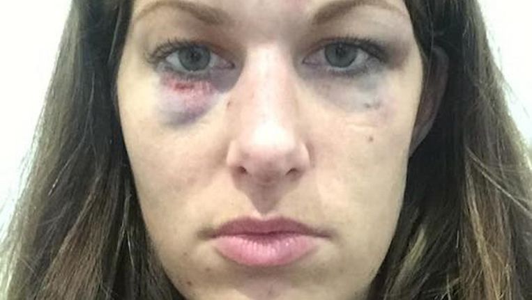 Vrouw 30 Uit Oost Buurman Sloeg Minutenlang Op Me In Het Parool