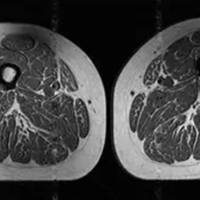 Veel ultrabewerkte voeding kan slechtere spierkwaliteit veroorzaken: ‘Dit onderstreept de cruciale rol van voeding’