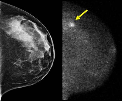 Advies: ga liever niet ’s middags naar de huisarts