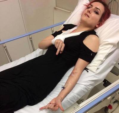 Tiener bedankt cosmeticamerk na gevaarlijk ongeluk: Make-up zit nog