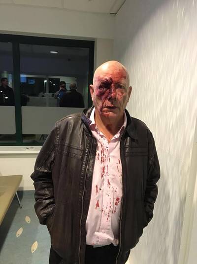 30.000 reacties voor in elkaar geslagen Danny (67) uit Arnhem