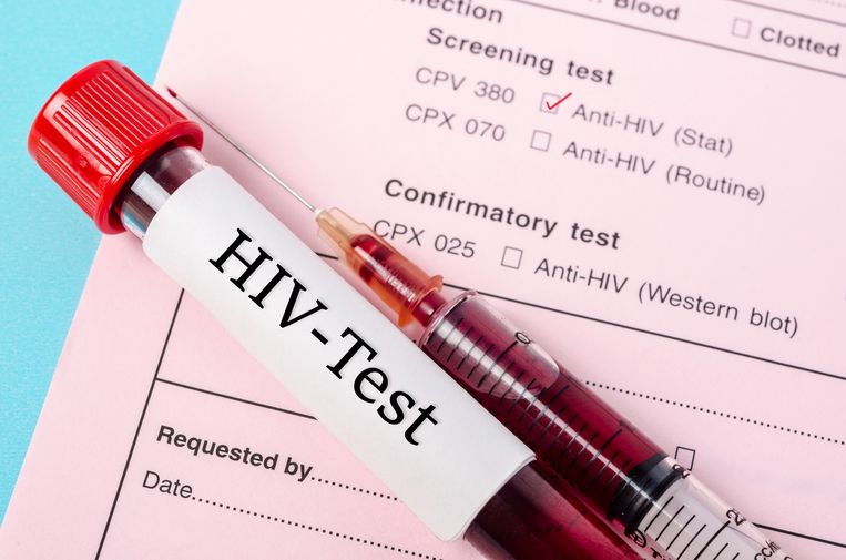 Wetenschappers ontdekken nieuwe en zeldzame variant hiv De