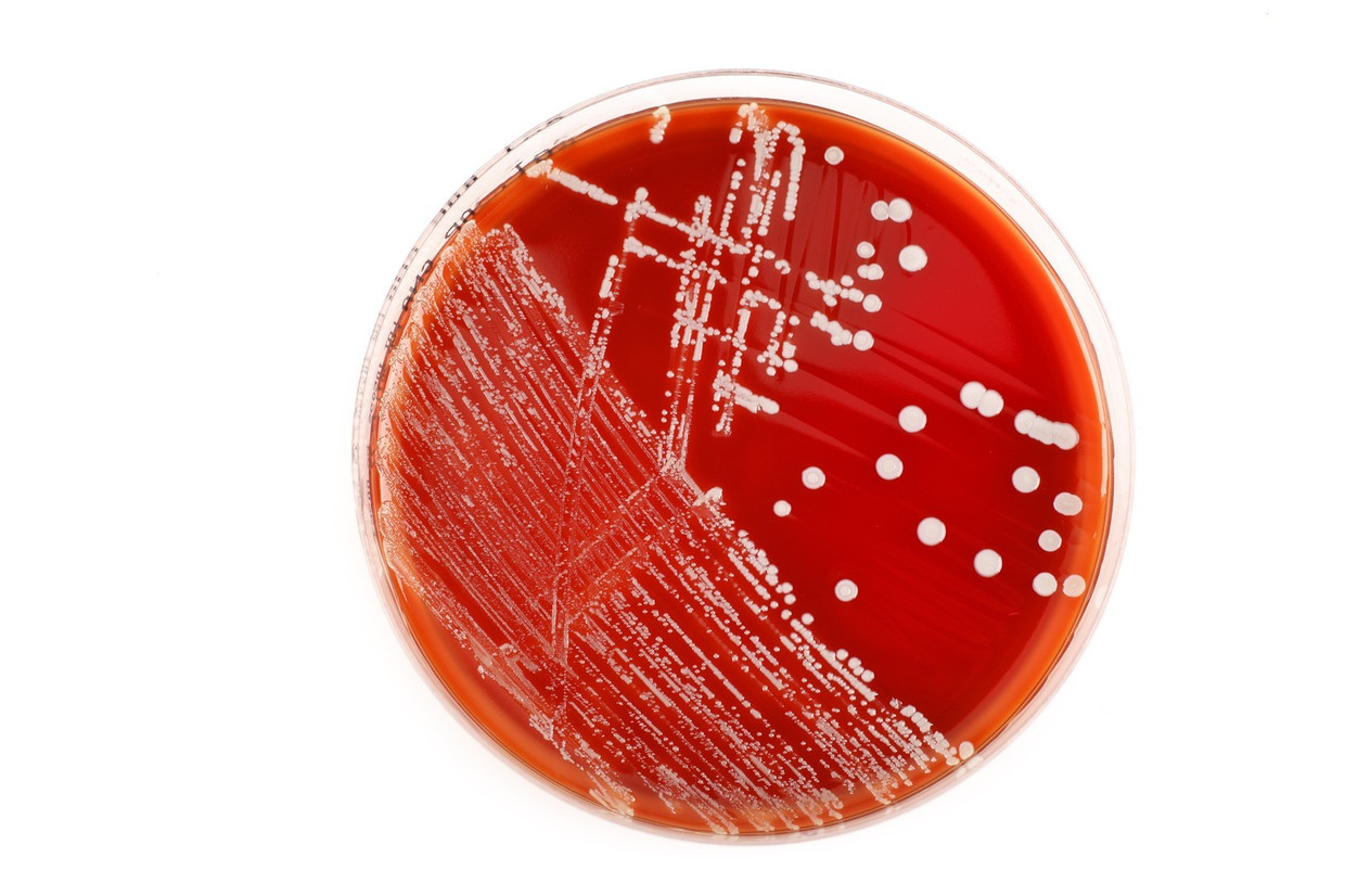 Dit Moet Ons Redden Als Antibiotica Zijn Uitgewerkt De Volkskrant