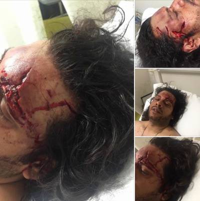 Hond takelt Enschedeër gruwelijk toe