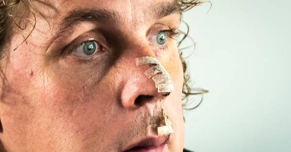Beveiliger Niels Boomkamp is voortaan 'de man met het litteken' - Tubantia