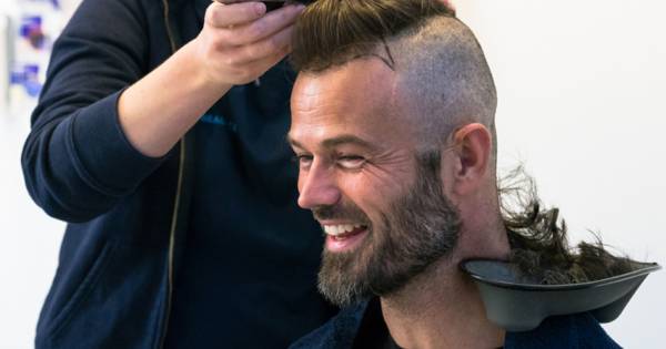 Kalende Arie Boomsma Onderging Haartransplantatie Show