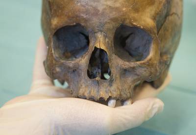 Nep-patholoog 'dr. Bones’ uit Bennekom komt voor de rechter