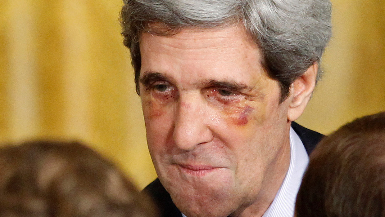 Kerry met gebroken neus en blauwe ogen in Witte Huis | Het ...