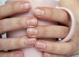 Witte vlekjes op je nagels? Dít kunnen de oorzaken zijn
