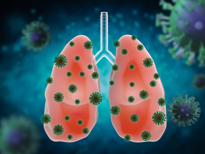 Het coronavirus slaat met name toe in de longen. Het medicijn dat wordt onderzocht gaat vochtophoping in de longen, iets wat de kans om het virus te overleven bijzonder verkleint, tegen.