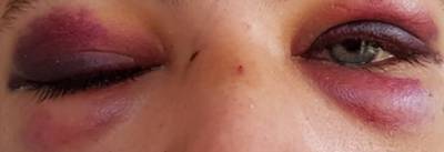 Jesse kreeg klappen van uitsmijter in Nijmegen: 'Ik wilde geen risico lopen'