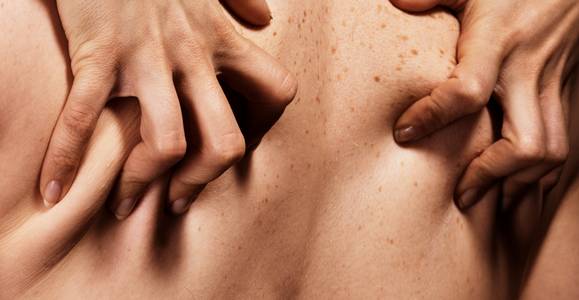 Swingers hebben weer intiem contact, wekelijks, met meerdere mensen. 