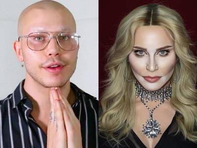 Transformatieartiest laat gezicht verbouwen na kritiek op eigen uiterlijk