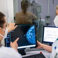 ‘Niet elke opgespoorde kanker had ooit problemen veroorzaakt’: UGent- onderzoek pleit voor genuanceerdere informatie over kankerscreening