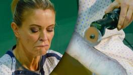 Karen snijdt gips gebroken arm open met elektrische zaag