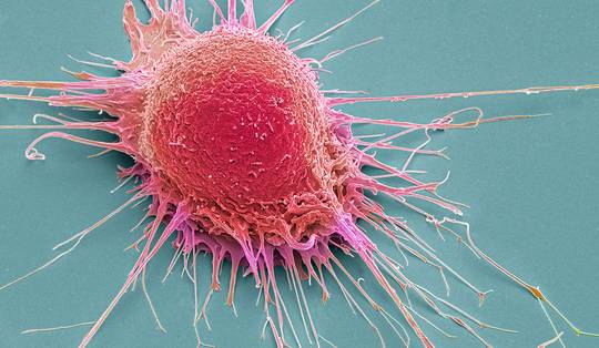 Wetenschappers ontdoen kankercellen van hun vermomming met behulp van geluidsgolven