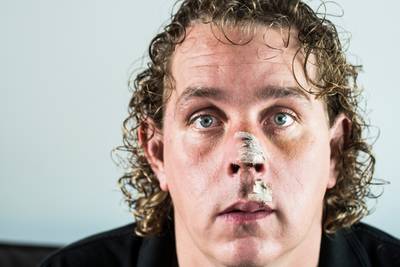 ‘Cruciale tip over mishandelde Bruins-beveiliger nog niet binnen’