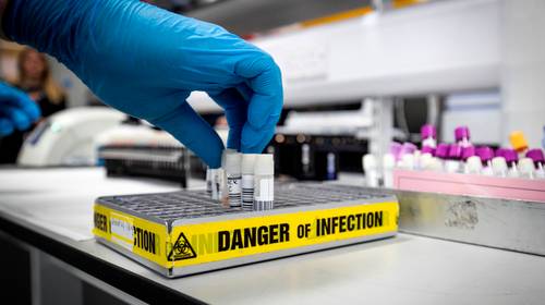 Hoe verloopt de coronatest precies? En wordt die ook terugbetaald?